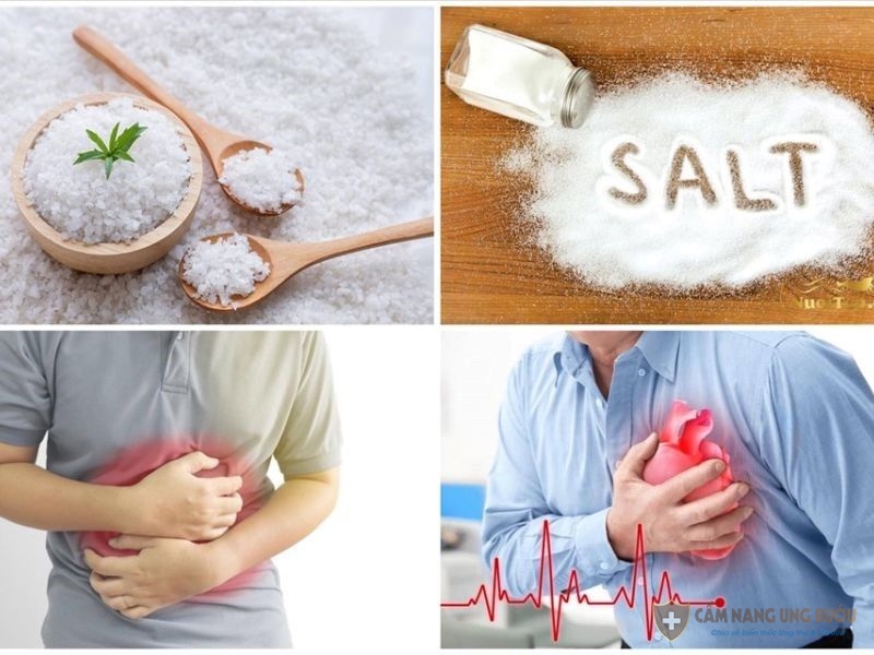 Chế độ ăn nhiều muối là nguyên nhân ung thư dạ dày phổ biến