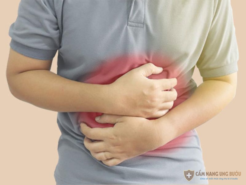 Dấu hiệu ung thư dạ dày giai đoạn 3
