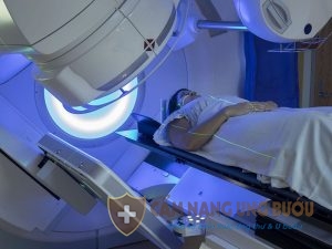 Phương pháp xạ trị