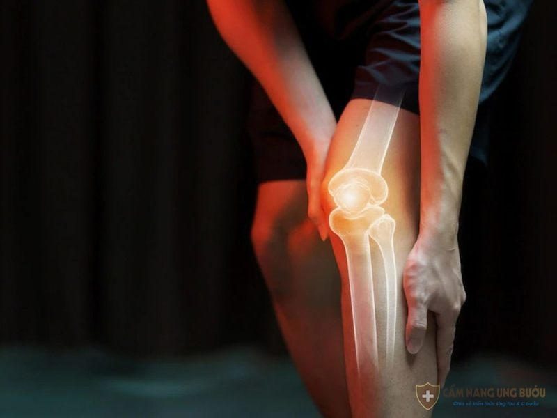 Căn bệnh ung thư xương chữa được không