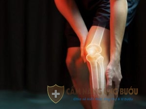 Căn bệnh ung thư xương sống được bao lâu