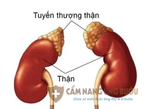 Căn bệnh ung thư tuyến thượng thận